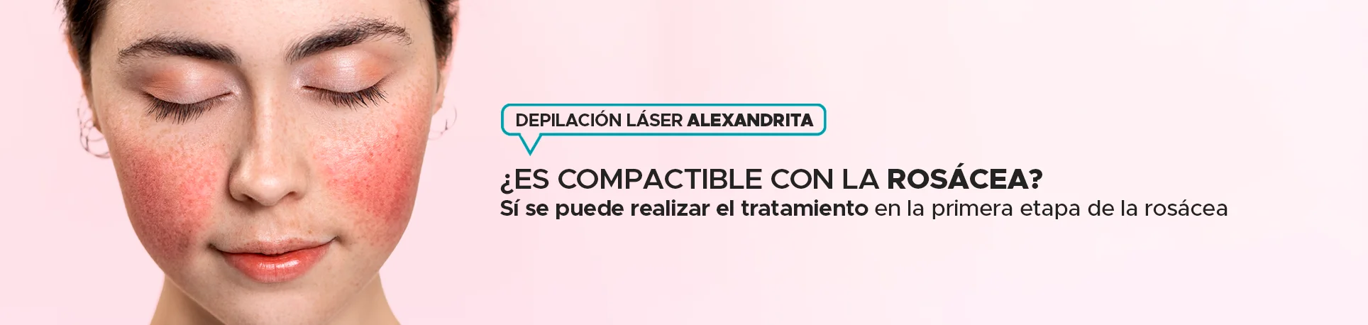 Depilación facial láser, cómo eliminar el vello de manera definitiva