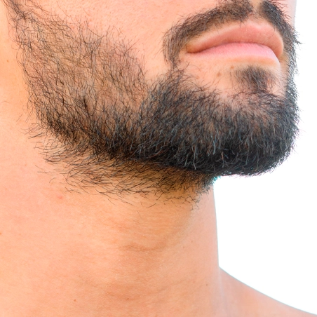 Depilacion Laser Masculina Base de Barba 2 sesiones gratis