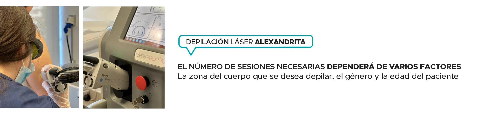 Sesiones discount laser necesarias