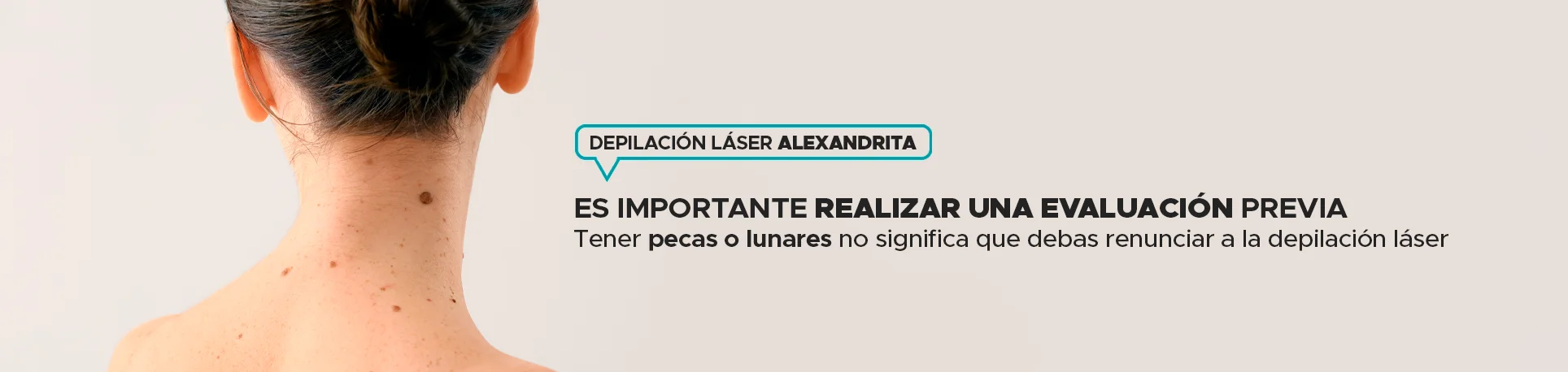 Depilacion Laser sobre lunares o piel con pecas